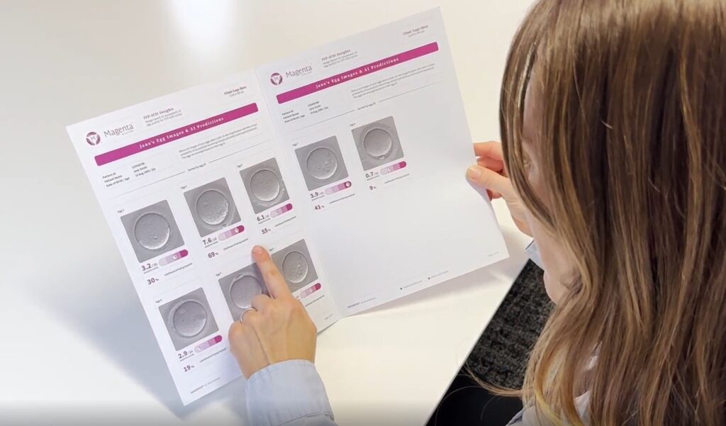 Fertilización in vitro